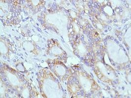 Immunohistochemistry (Formalin/PFA-fixed paraffin-embedded sections) - Anti-CD38 antibody [SP149] - C-terminal (ab183326), expandable thumbnail