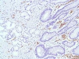 Immunohistochemistry (Formalin/PFA-fixed paraffin-embedded sections) - Anti-CD38 antibody [SP149] - C-terminal (ab183326), expandable thumbnail