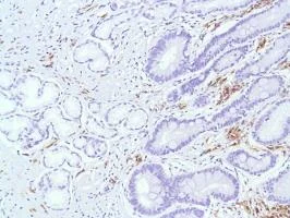 Immunohistochemistry (Formalin/PFA-fixed paraffin-embedded sections) - Anti-CD38 antibody [SP149] - C-terminal (AB183326)