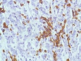 Immunohistochemistry (Formalin/PFA-fixed paraffin-embedded sections) - Anti-CD38 antibody [SP149] - C-terminal (ab183326), expandable thumbnail