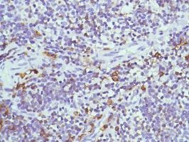 Immunohistochemistry (Formalin/PFA-fixed paraffin-embedded sections) - Anti-CD38 antibody [SP149] - C-terminal (ab183326), expandable thumbnail