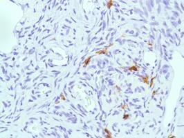 Immunohistochemistry (Formalin/PFA-fixed paraffin-embedded sections) - Anti-CD38 antibody [SP149] - C-terminal (AB183326), expandable thumbnail