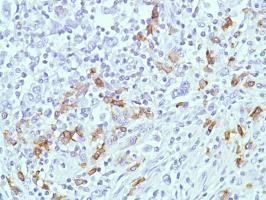 Immunohistochemistry (Formalin/PFA-fixed paraffin-embedded sections) - Anti-CD38 antibody [SP149] - C-terminal (ab183326), expandable thumbnail