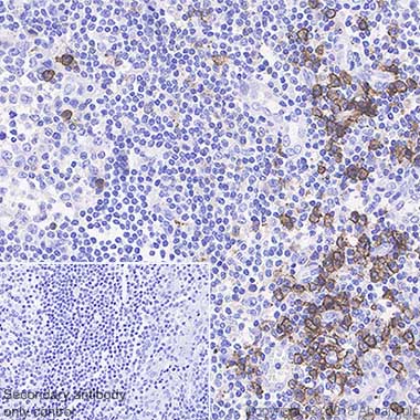 Immunohistochemistry (Formalin/PFA-fixed paraffin-embedded sections) - Anti-CD38 antibody [SP149] - C-terminal (AB183326), expandable thumbnail
