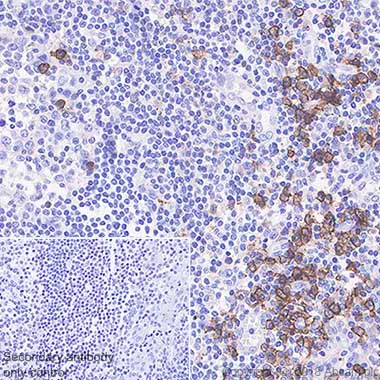 Immunohistochemistry (Formalin/PFA-fixed paraffin-embedded sections) - Anti-CD38 antibody [SP149] - C-terminal (AB183326)