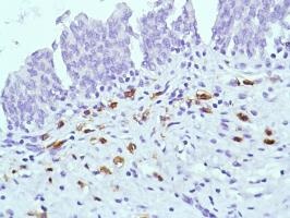 Immunohistochemistry (Formalin/PFA-fixed paraffin-embedded sections) - Anti-CD38 antibody [SP149] - C-terminal (ab183326), expandable thumbnail