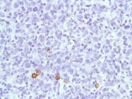 Immunohistochemistry (Formalin/PFA-fixed paraffin-embedded sections) - Anti-CD38 antibody [SP149] - C-terminal (ab183326), expandable thumbnail