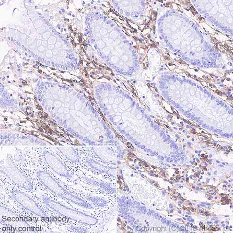 Immunohistochemistry (Formalin/PFA-fixed paraffin-embedded sections) - Anti-CD38 antibody [SP149] - C-terminal (AB183326)