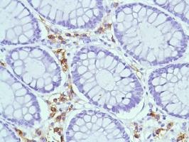 Immunohistochemistry (Formalin/PFA-fixed paraffin-embedded sections) - Anti-CD38 antibody [SP149] - C-terminal (ab183326), expandable thumbnail
