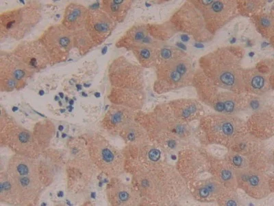 Immunohistochemistry (Formalin/PFA-fixed paraffin-embedded sections) - Anti-CD39 antibody (AB231983)