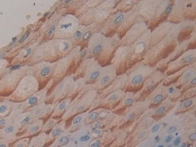 Immunohistochemistry (Formalin/PFA-fixed paraffin-embedded sections) - Anti-CD39 antibody (AB231983)