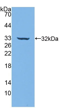 Western blot - Anti-CD39 antibody (AB231983)