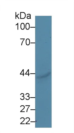 Western blot - Anti-CD39 antibody (AB231983)