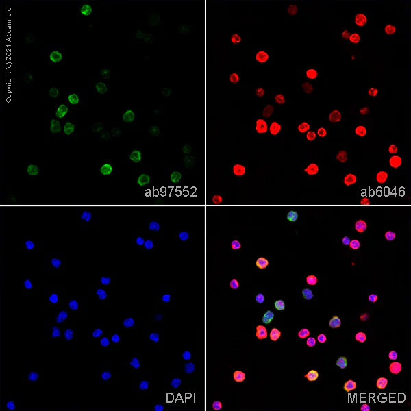 Immunocytochemistry/ Immunofluorescence - Anti-CD39 antibody [AC2] (AB97552)