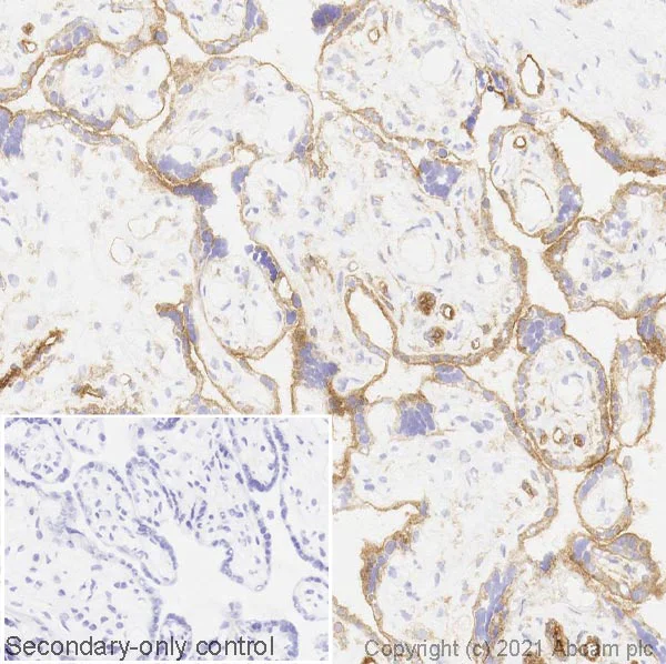 Immunohistochemistry (Frozen sections) - Anti-CD39 antibody [AC2] (AB97552)