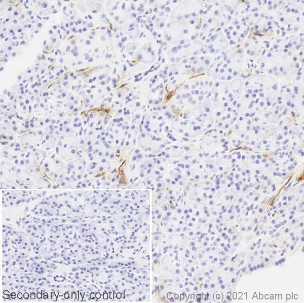 Immunohistochemistry (Frozen sections) - Anti-CD39 antibody [AC2] (AB97552)