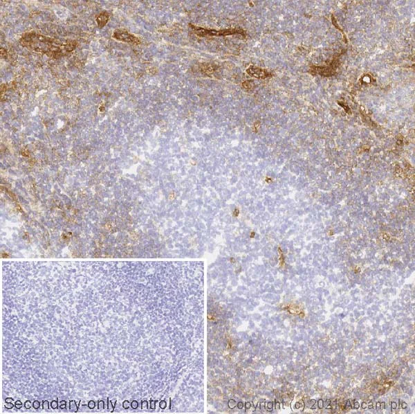 Immunohistochemistry (Frozen sections) - Anti-CD39 antibody [AC2] (AB97552)