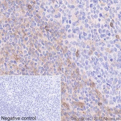 Immunohistochemistry (Formalin/PFA-fixed paraffin-embedded sections) - Anti-CD39 antibody [EPR20461] - BSA and Azide free (AB232537)