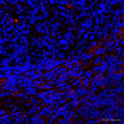 Immunohistochemistry (Formalin/PFA-fixed paraffin-embedded sections) - Anti-CD39 antibody [EPR20461] - BSA and Azide free (AB232537)