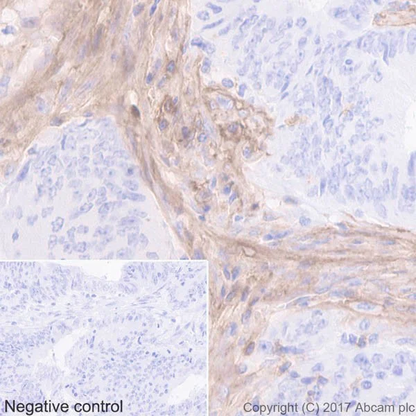 Immunohistochemistry (Formalin/PFA-fixed paraffin-embedded sections) - Anti-CD39 antibody [EPR20461] - BSA and Azide free (AB232537)
