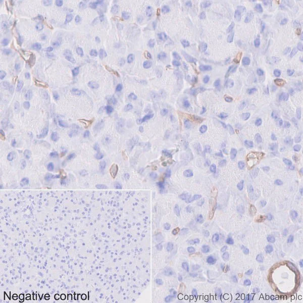 Immunohistochemistry (Formalin/PFA-fixed paraffin-embedded sections) - Anti-CD39 antibody [EPR20461] - BSA and Azide free (AB232537)