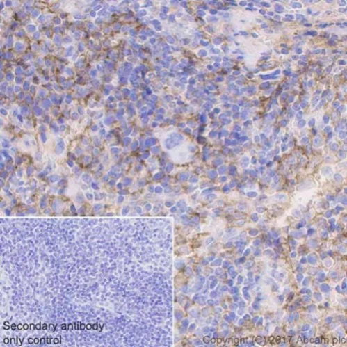 Immunohistochemistry (Formalin/PFA-fixed paraffin-embedded sections) - Anti-CD39 antibody [EPR20627] (AB223842)