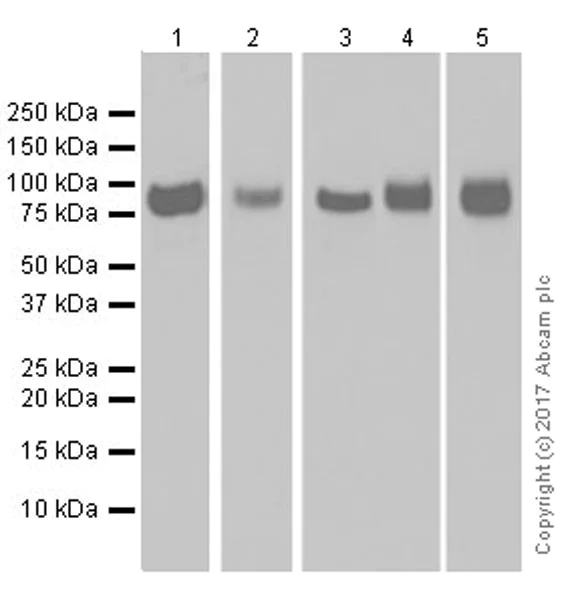 Western blot - Anti-CD39 antibody [EPR20627] (AB223842)