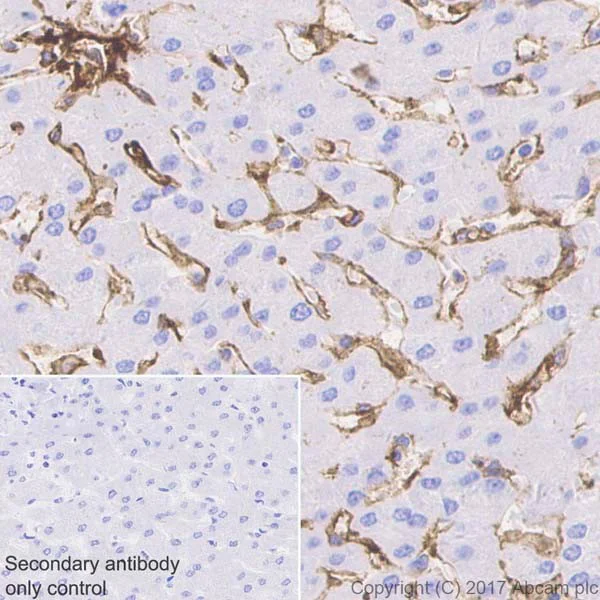 Immunohistochemistry (Formalin/PFA-fixed paraffin-embedded sections) - Anti-CD39 antibody [EPR20627] - BSA and Azide free (AB236038)