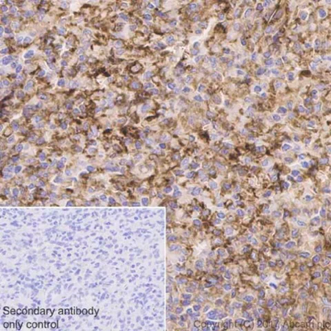 Immunohistochemistry (Formalin/PFA-fixed paraffin-embedded sections) - Anti-CD39 antibody [EPR20627] - BSA and Azide free (AB236038)
