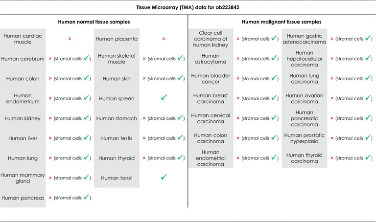 Immunohistochemistry (Formalin/PFA-fixed paraffin-embedded sections) - Anti-CD39 antibody [EPR20627] - BSA and Azide free (AB236038)