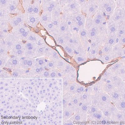 Immunohistochemistry (Formalin/PFA-fixed paraffin-embedded sections) - Anti-CD39 antibody [EPR22507-48] (AB227840)
