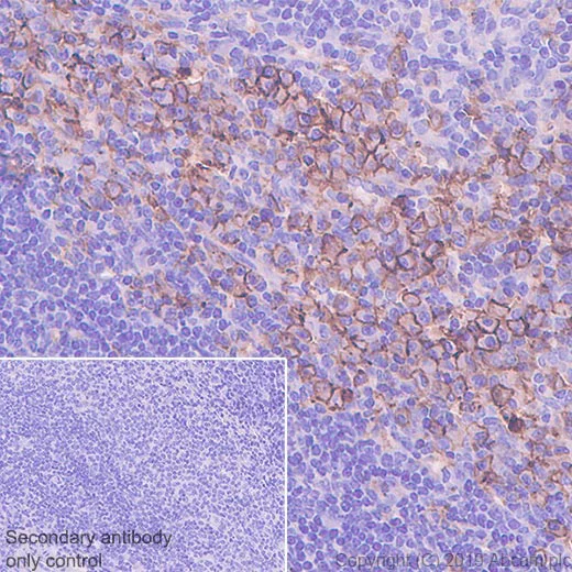 Immunohistochemistry (Formalin/PFA-fixed paraffin-embedded sections) - Anti-CD39 antibody [EPR22507-48] - BSA and Azide free (AB254006)