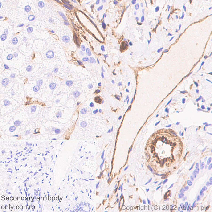 Immunohistochemistry (Formalin/PFA-fixed paraffin-embedded sections) - Anti-CD39 antibody [EPR26473-58] (AB300065)