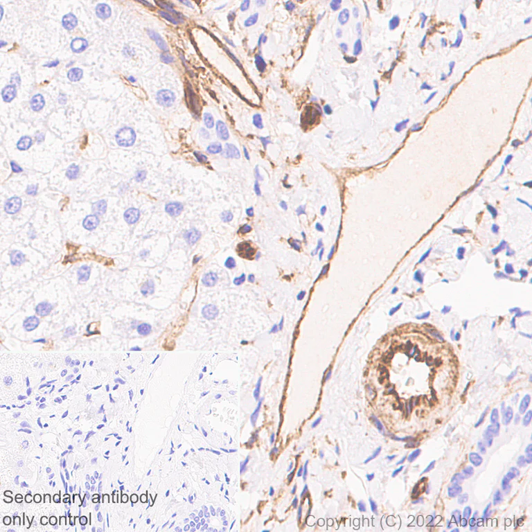 Immunohistochemistry (Formalin/PFA-fixed paraffin-embedded sections) - Anti-CD39 antibody [EPR26473-58] (BSA and Azide free) (AB300066)