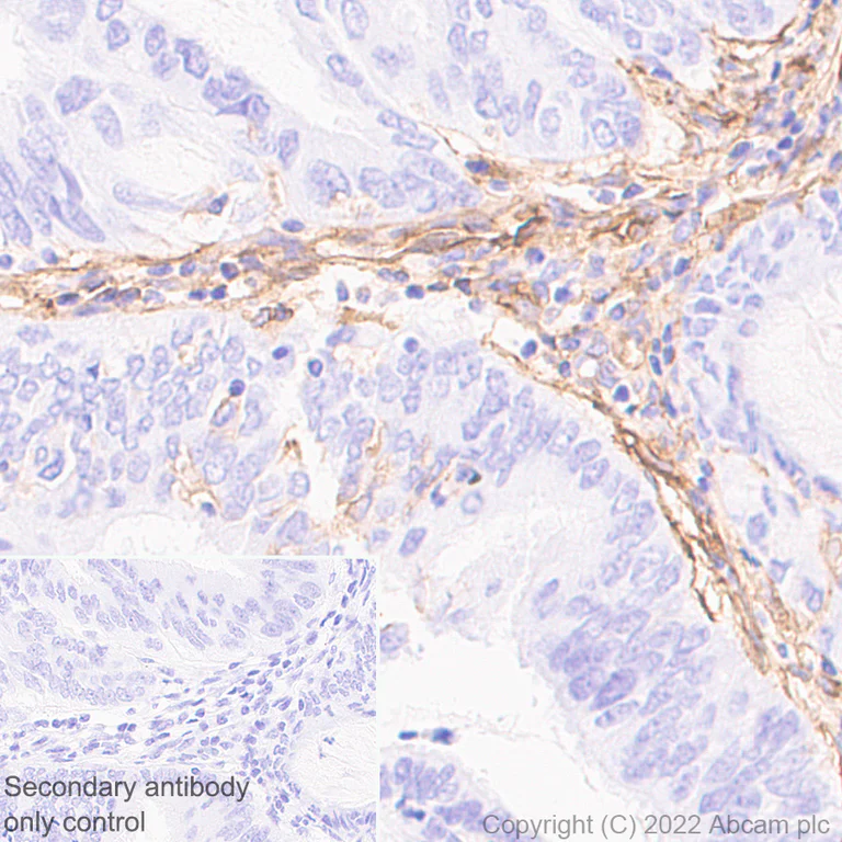 Immunohistochemistry (Formalin/PFA-fixed paraffin-embedded sections) - Anti-CD39 antibody [EPR26473-58] (BSA and Azide free) (AB300066)