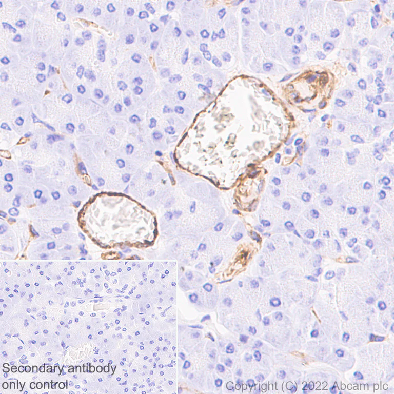 Immunohistochemistry (Formalin/PFA-fixed paraffin-embedded sections) - Anti-CD39 antibody [EPR26473-58] (BSA and Azide free) (AB300066)