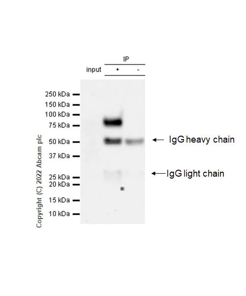 Immunoprecipitation - Anti-CD39 antibody [EPR26473-58] (BSA and Azide free) (AB300066)