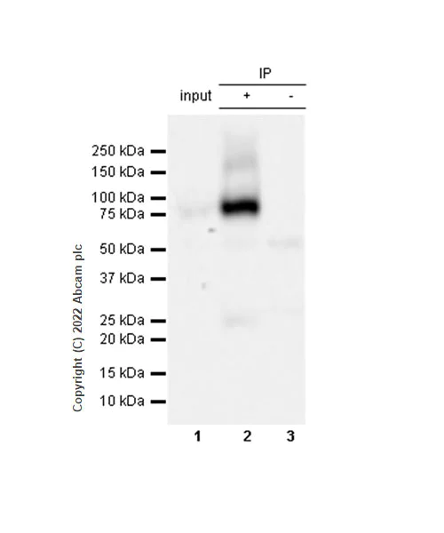 Immunoprecipitation - Anti-CD39 antibody [EPR26473-58] (BSA and Azide free) (AB300066)