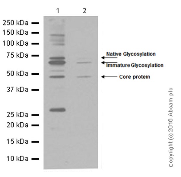 Western blot - Anti-CD39 antibody [EPR3678(2)] (AB108248), expandable thumbnail