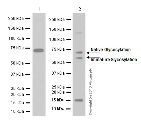 Western blot - Anti-CD39 antibody [EPR3678(2)] (AB108248), expandable thumbnail