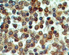 Immunohistochemistry (Formalin/PFA-fixed paraffin-embedded sections) - Anti-CD39 antibody [IMG17B5F11] (AB178572)