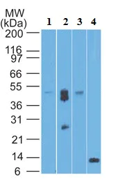 Western blot - Anti-CD39 antibody [IMG17B5F11] (AB178572)