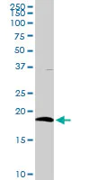 Western blot - Anti-CD3D antibody (AB103573)