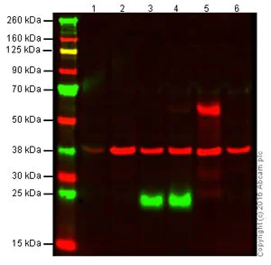 Western blot - Anti-CD3D antibody [EP4426] (AB109531)