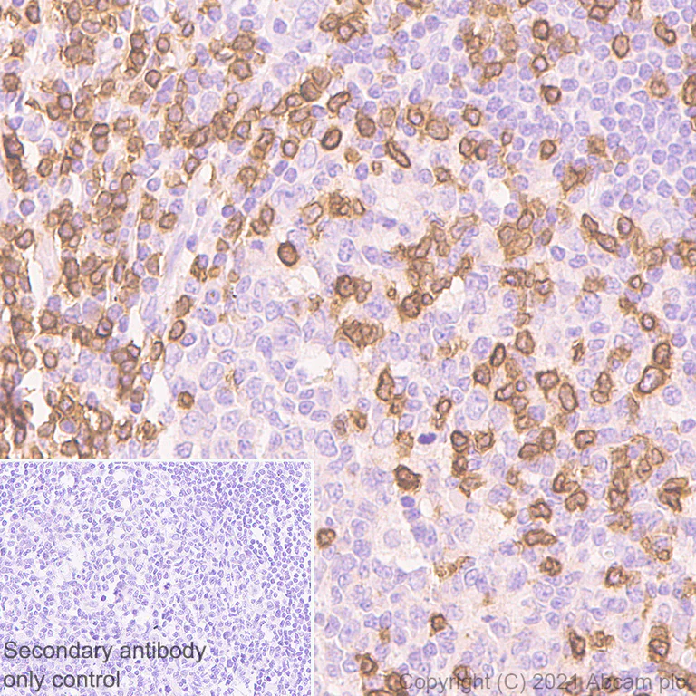 Immunohistochemistry (Formalin/PFA-fixed paraffin-embedded sections) - Anti-CD3D antibody [EP4426] - Low endotoxin, Azide free (AB215040)