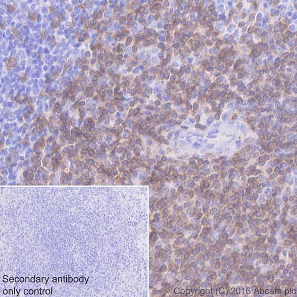 Immunohistochemistry (Formalin/PFA-fixed paraffin-embedded sections) - Anti-CD3D antibody [EPR20544] (AB213362), expandable thumbnail
