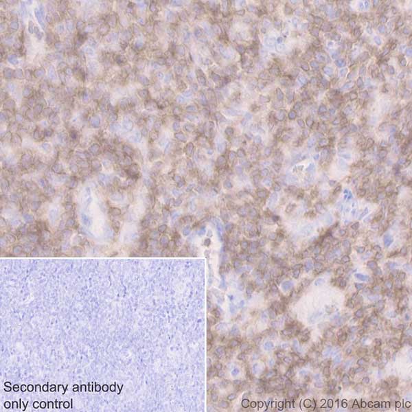 Immunohistochemistry (Formalin/PFA-fixed paraffin-embedded sections) - Anti-CD3D antibody [EPR20544] (ab213362), expandable thumbnail