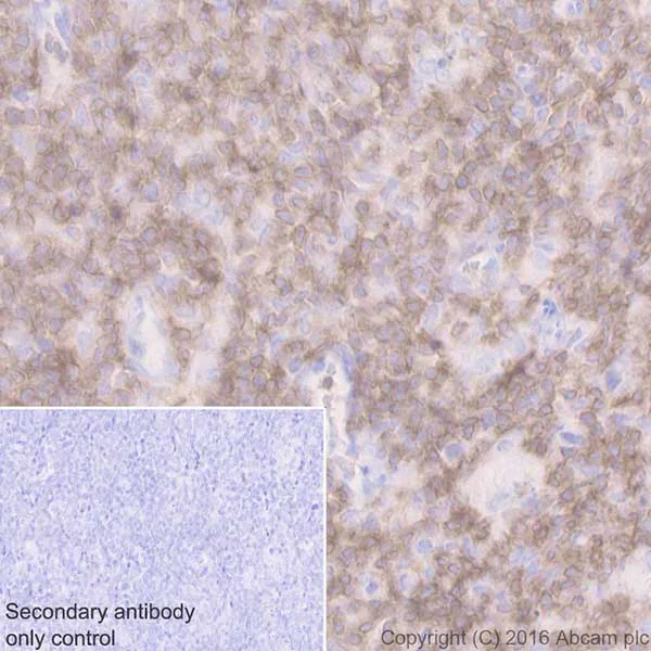 Immunohistochemistry (Formalin/PFA-fixed paraffin-embedded sections) - Anti-CD3D antibody [EPR20544] - BSA and Azide free (AB229280)