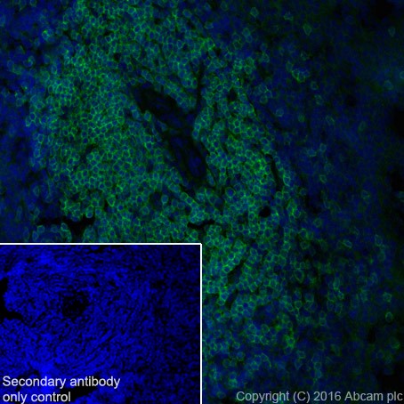 Immunohistochemistry (Frozen sections) - Anti-CD3D antibody [EPR20544] - BSA and Azide free (AB229280)