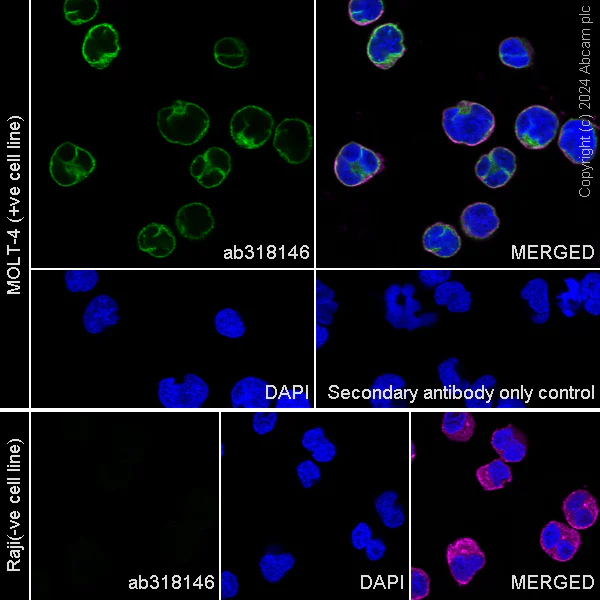 Immunocytochemistry/ Immunofluorescence - Anti-CD3D+CD3G+CD3 epsilon antibody [RM1128] (AB318146)